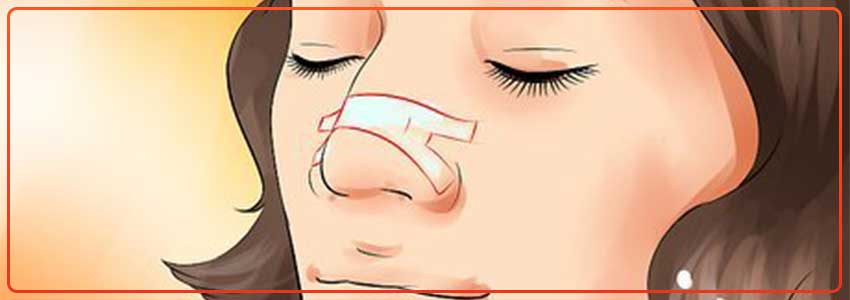 Nasal Strips for Snoring: How Do They Work?